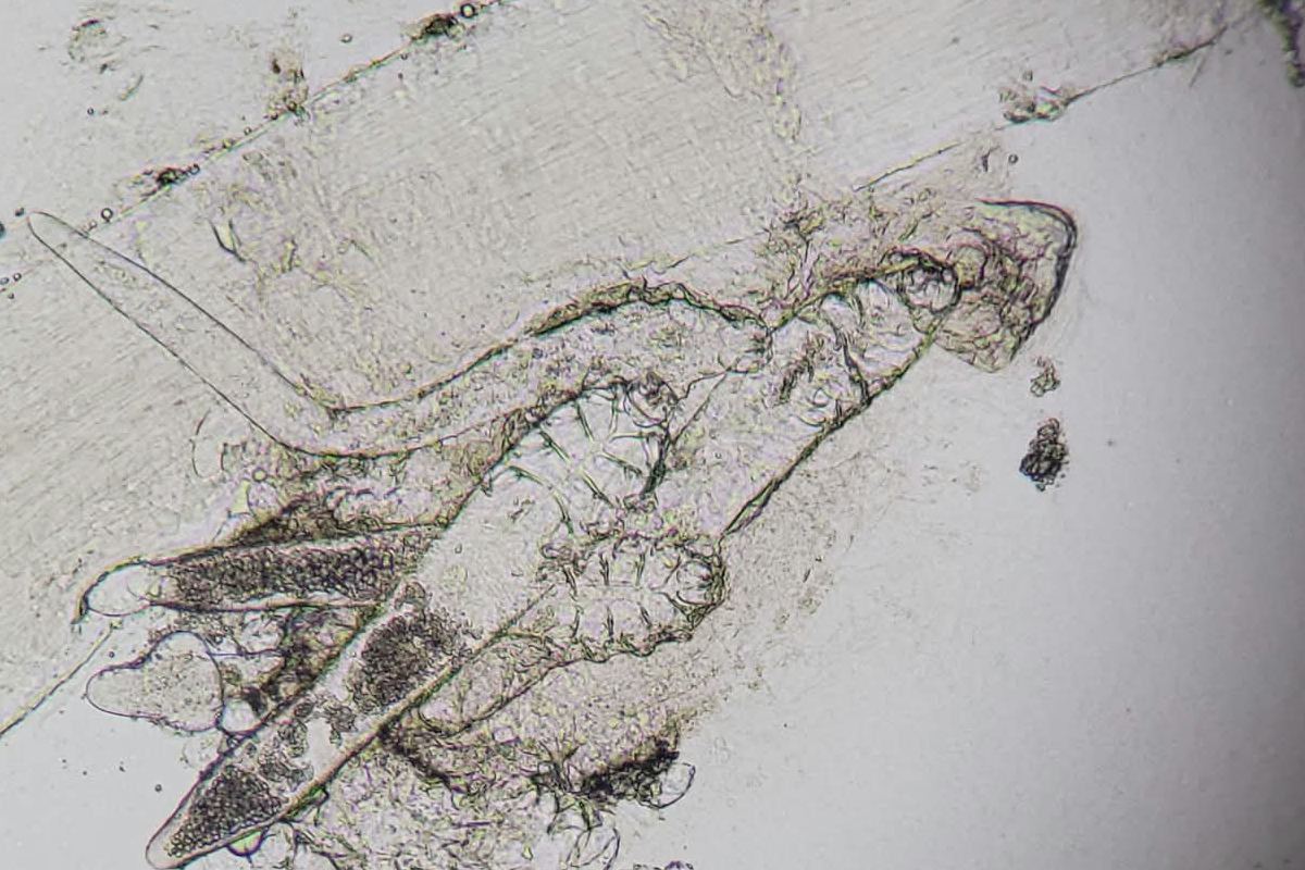 Nużeniec Demodex spp. w autentycznym obrazie mikroskopowym Laboratorium FACTOR